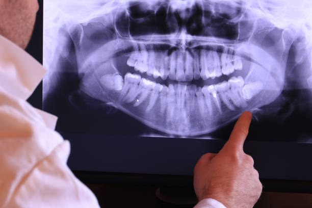 Best Broken or Cracked Tooth Emergency Dentist in Rockaway Beach, OR